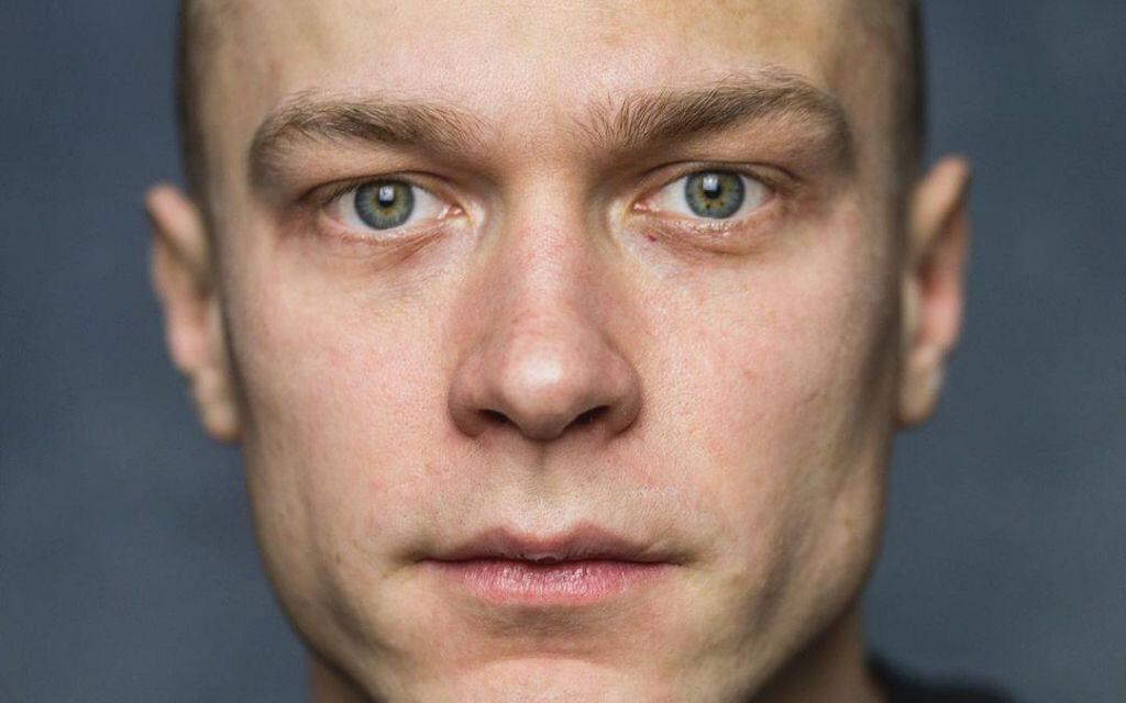 Tag der glatzköpfigen Männer: Schauspieler ohne Haare feiern