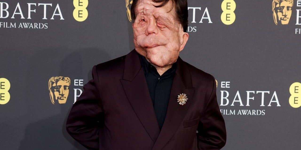 Adam Pearson als „Elefantenmensch“ in Berlin: Ein bewegendes Erlebnis