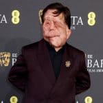 Adam Pearson als „Elefantenmensch“ in Berlin: Ein bewegendes Erlebnis