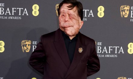 Adam Pearson als „Elefantenmensch“ in Berlin: Ein bewegendes Erlebnis